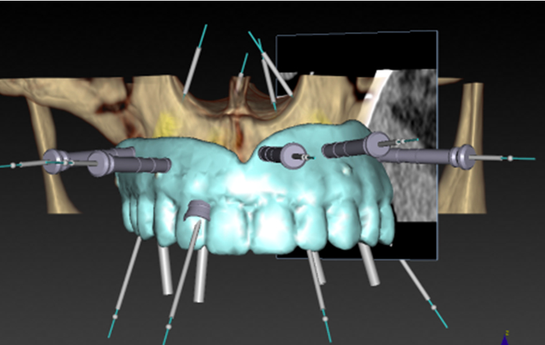 Megacis USA Dental Lab | 1962 W Corporate Way, Anaheim, CA 92801, USA | Phone: (714) 502-0900