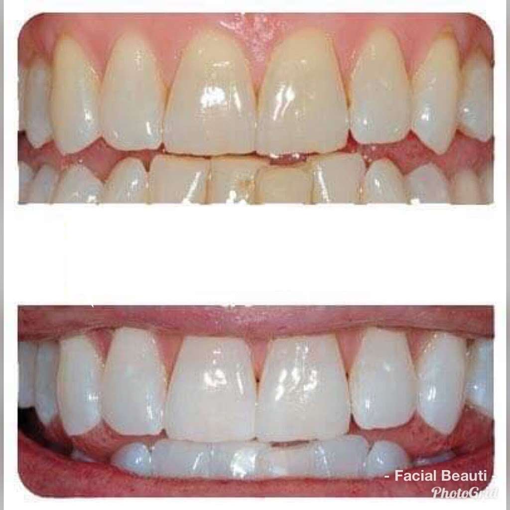 Facial Services by Jackie | 11717 Bauman Rd A, Houston, TX 77076, USA | Phone: (713) 459-9729