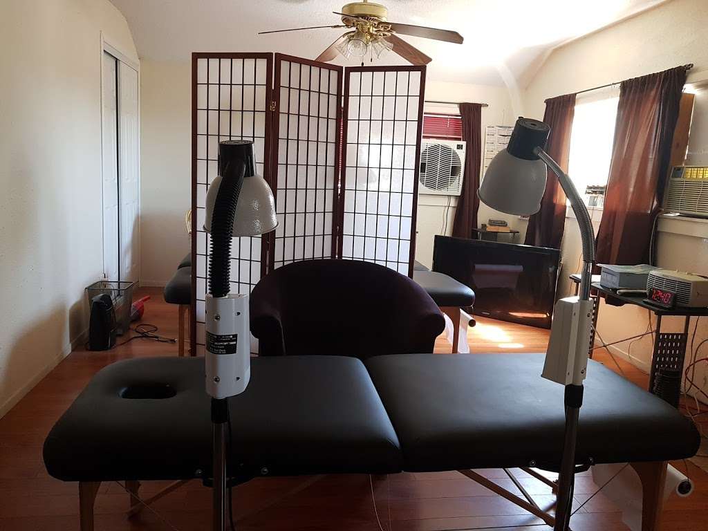 myKorWellness Acupuncture | 3701 50th St W, Rosamond, CA 93560 | Phone: (213) 984-1199