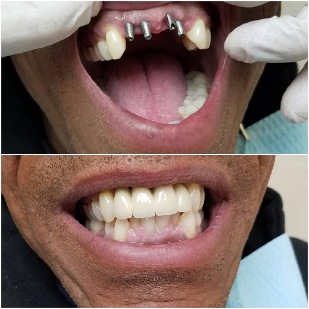 Cohens Gentle Dental: Kevan Hosseini, DMD | 100 Alcott Pl, The Bronx, NY 10475, USA | Phone: (718) 585-4400