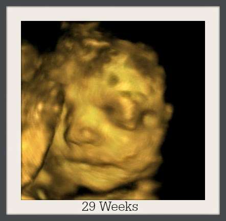 Bella Baby 4D Ultrasound of Houston | 3411 Cedar Knolls Dr, Kingwood, TX 77339 | Phone: (281) 407-0470