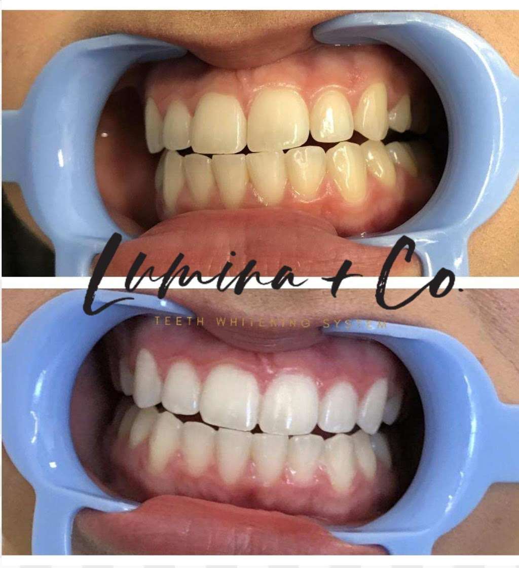 Lumina + Co. Teeth Whitening System | 1940 W Chandler Blvd #5 Studio 22, Chandler, AZ 85224, USA | Phone: (801) 500-1027