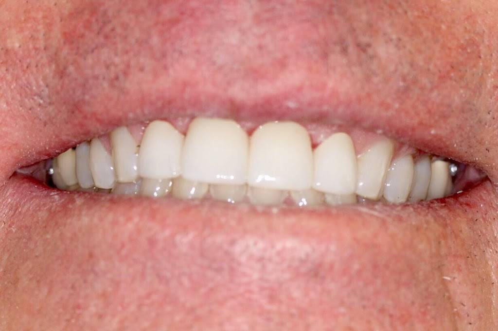 Rio Del Mar Dental | 9520 Soquel Dr, Aptos, CA 95003, USA | Phone: (831) 580-1142