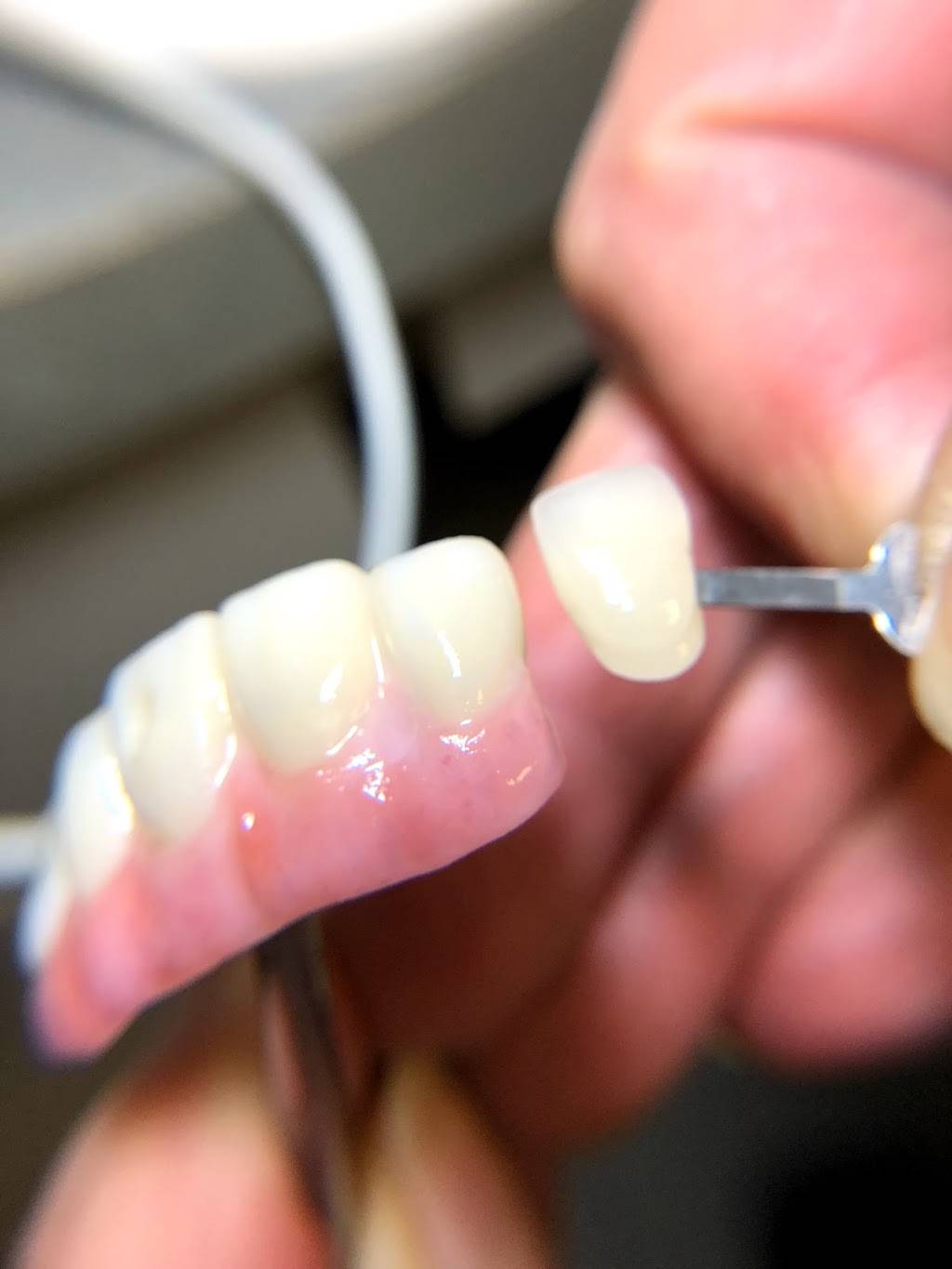 Precision Dental Arts | 3220 N Bronco St #101, Las Vegas, NV 89108, USA | Phone: (702) 396-1090