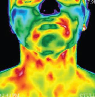 West Coast Thermography | 522 Jamacha Road, @Inner Fit Wellness 2nd Floor, El Cajon, CA 92019, USA | Phone: (619) 647-4374