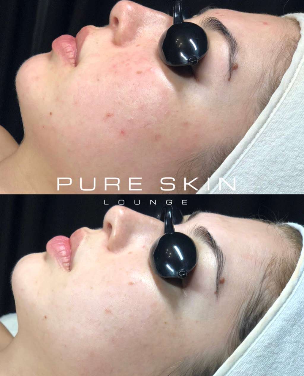 Pure Skin Lounge | 1425 University Ave Ste B, San Diego, CA 92103 | Phone: (619) 354-6826