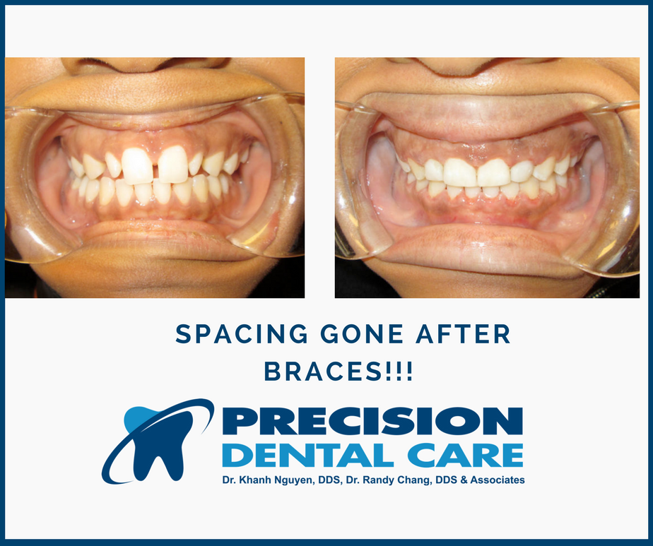 Precision Dental Care | 4317 S Ashland Ave, Chicago, IL 60609, USA | Phone: (773) 579-0422