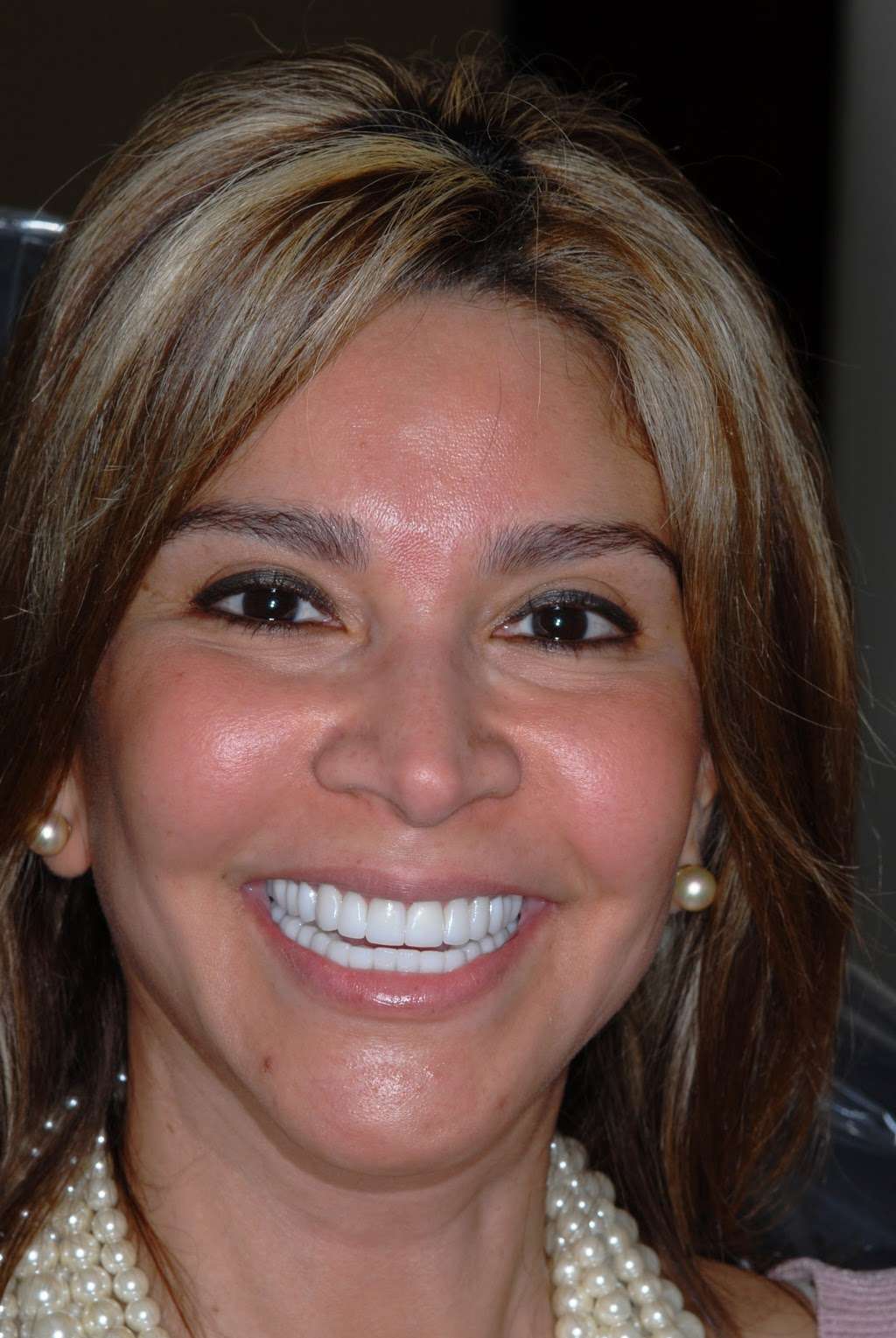 Texas Center for Cosmetic Dentistry | 4800 W Panther Creek Dr Suite 200, The Woodlands, TX 77381, USA | Phone: (281) 612-5220