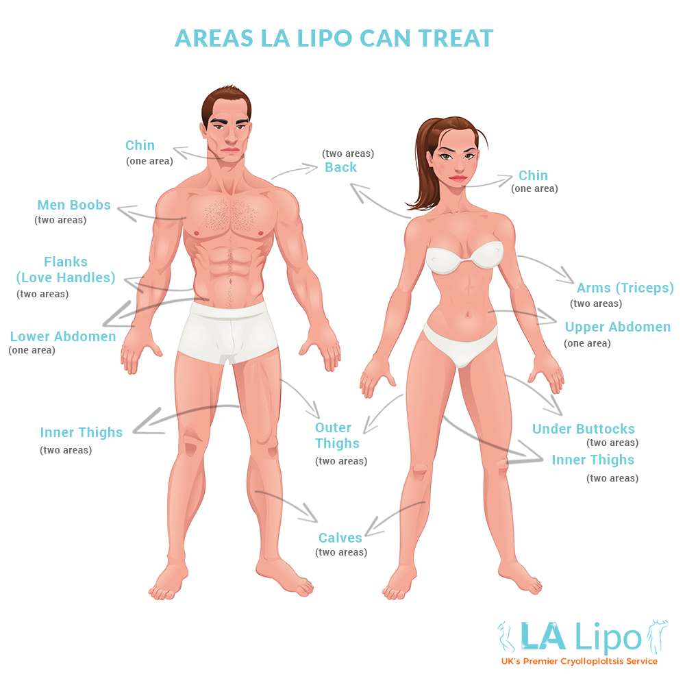 LA Lipo Radlett | 349 Watling St, Radlett WD7 7LB, UK | Phone: 01923 553038