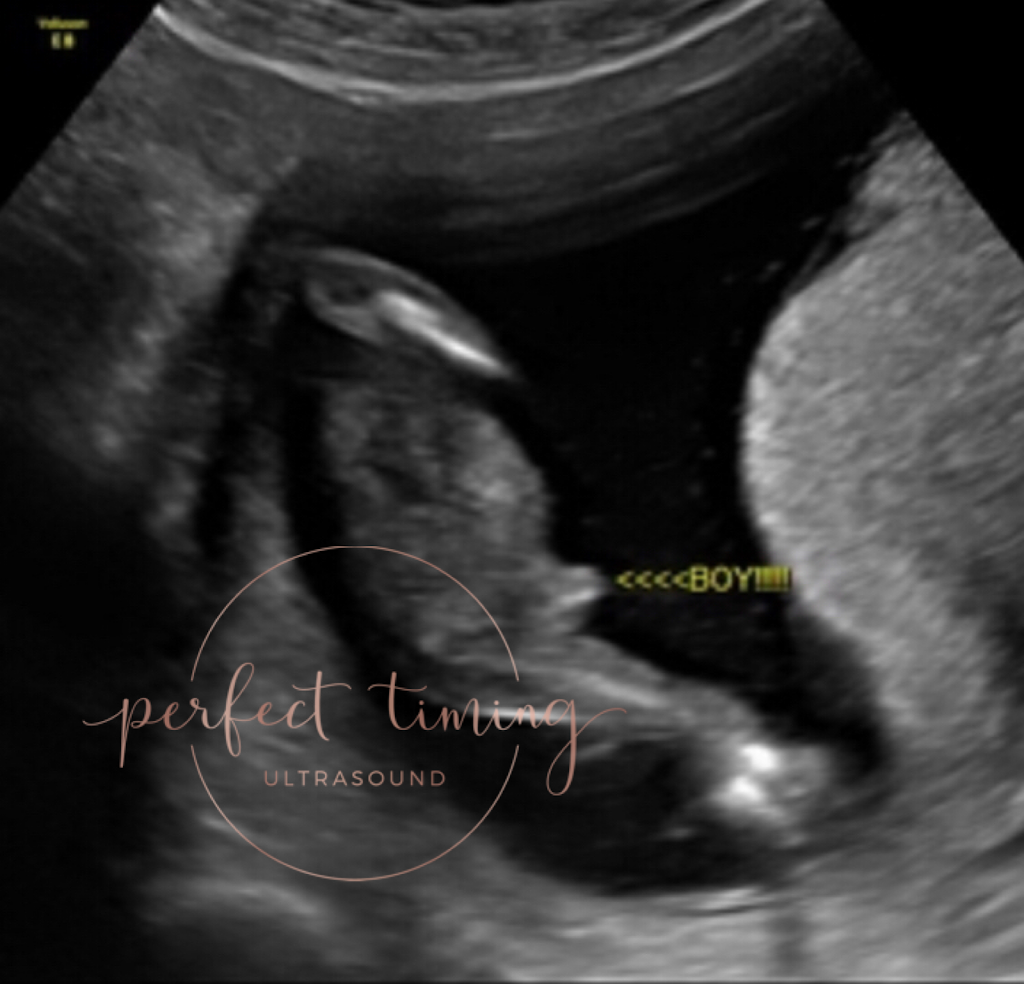 Perfect Timing Ultrasound | 6 Resnik Rd #202, Plymouth, MA 02360, USA | Phone: (508) 591-7956