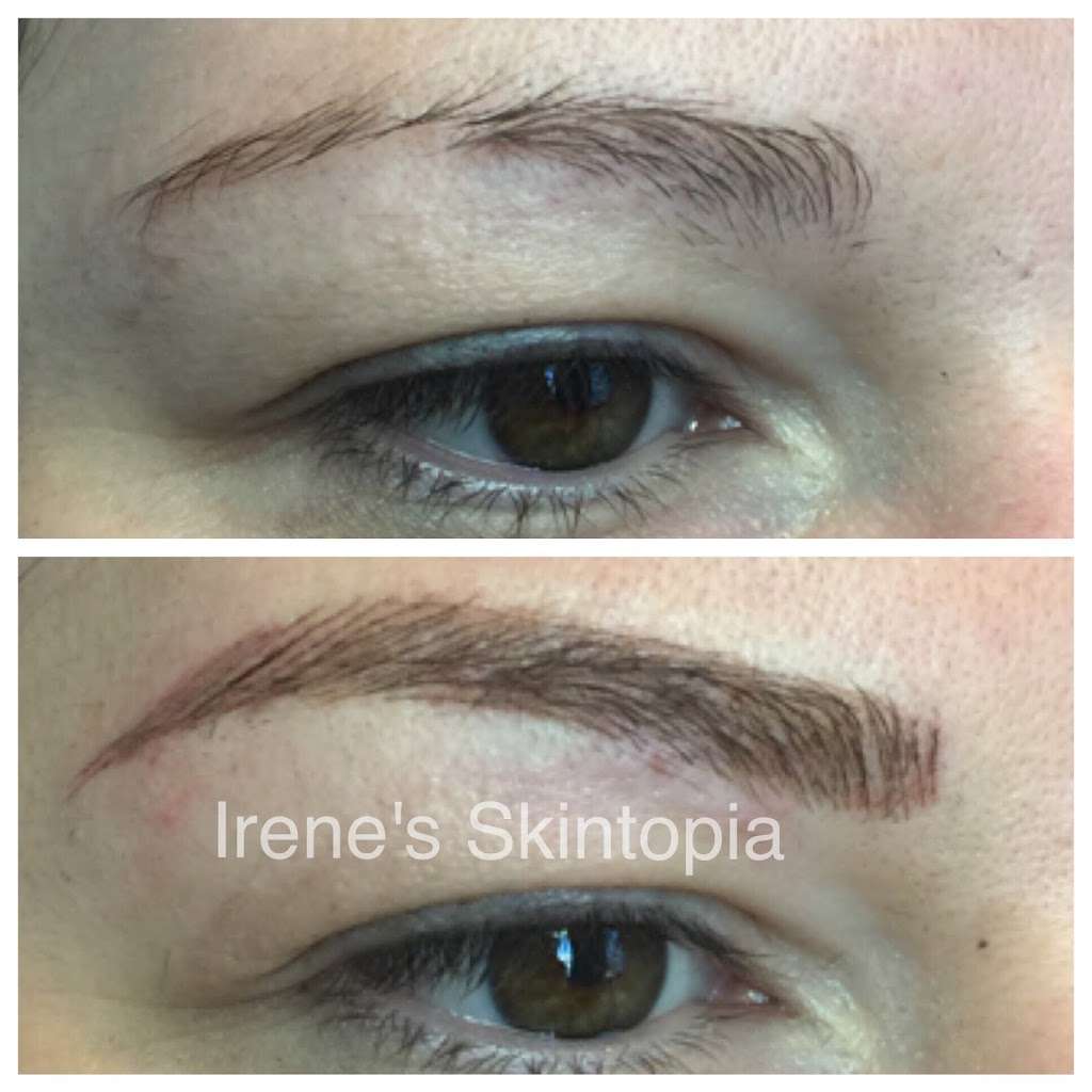 Irenes Skintopia | 3130 W Olympic Blvd #270, Los Angeles, CA 90006, USA | Phone: (213) 703-7037