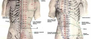 Meis Acupuncture | 7232 Sand Lake Rd Suite 201, Orlando, FL 32819, United States | Phone: (407) 624-4674