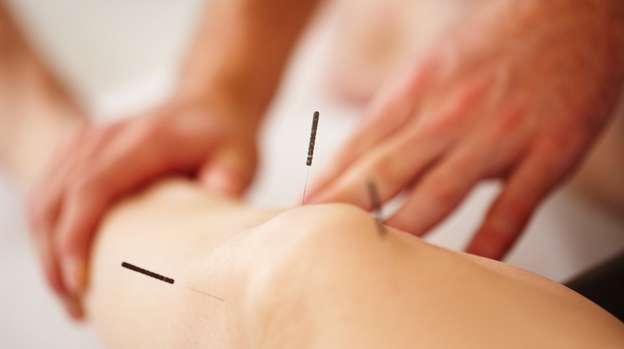 Pasadena Acupuncture and Foot Reflexology | 956 N Lake Ave, Pasadena, CA 91104, USA | Phone: (626) 398-8298