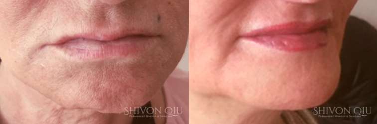 Shivon Qiu Microblading & Permanent Makeup | 60 Richmond Way, Hammersmith, London W14 0AS, UK | Phone: 07880 369625