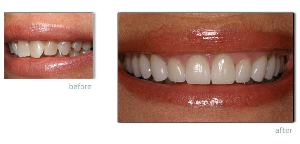 Synergy Dental Ceramics by Roberto Rossi | 700 Hillside Avenue, New Hyde Park, NY 11040, USA | Phone: (516) 877-8089