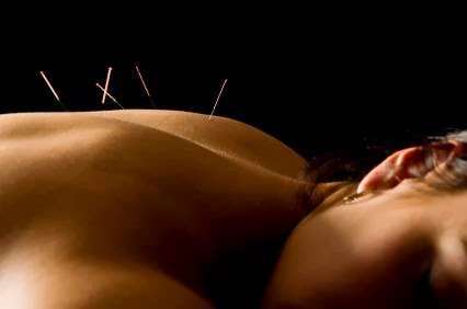 Baltimore Acupuncture for Health | 307 Patleigh Rd, Catonsville, MD 21228 | Phone: (410) 788-1851