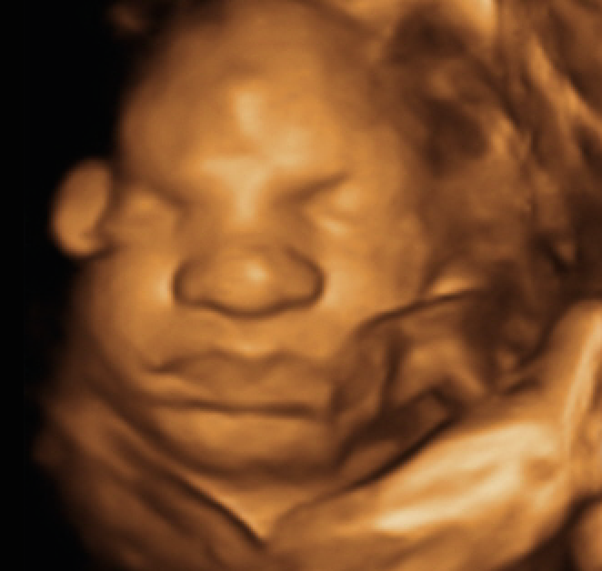 My Sweet Baby 3D/4D Ultrasounds | 5530 25th St, Columbus, IN 47203 | Phone: (812) 260-1881