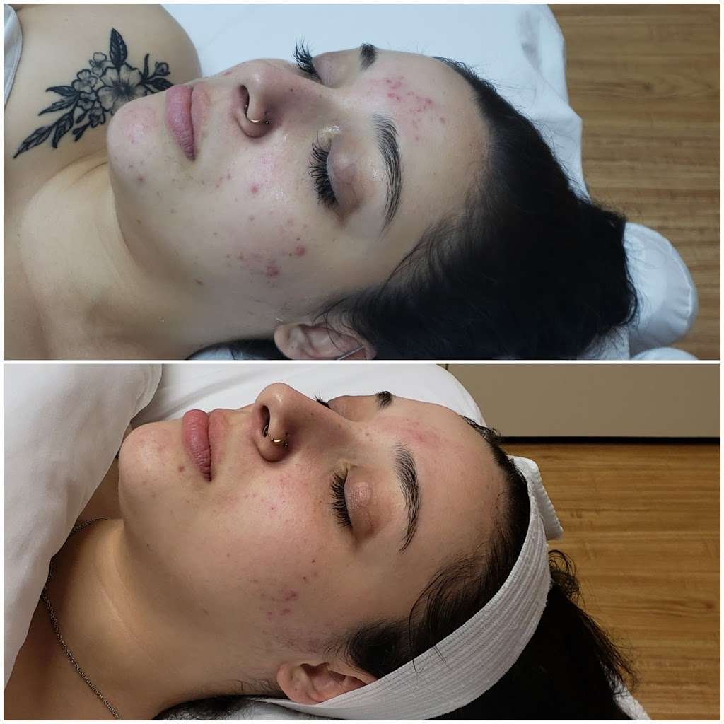 Kalon Skin Studio | 15237 Southwest Fwy, Sugar Land, TX 77478, USA | Phone: (832) 291-2636