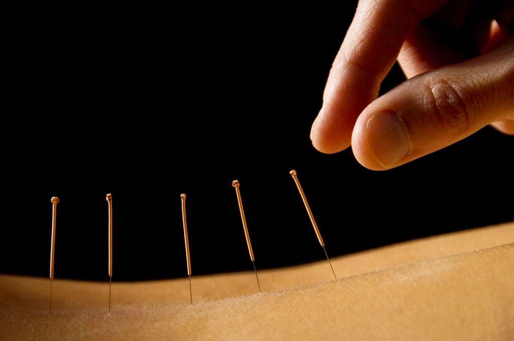 Won Institute of Graduate Studies Acupuncture Clinics | 137 S Easton Rd, Glenside, PA 19038, USA | Phone: (215) 884-8942