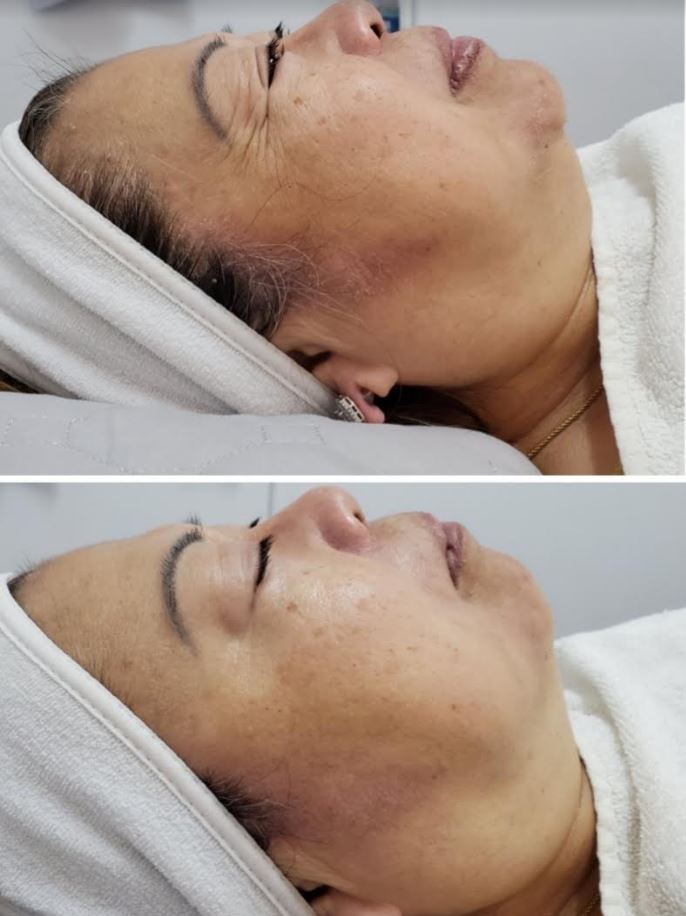 Joy Ferris Facial Center | 101B Hickey Blvd, South San Francisco, CA 94080, USA | Phone: (415) 568-6058