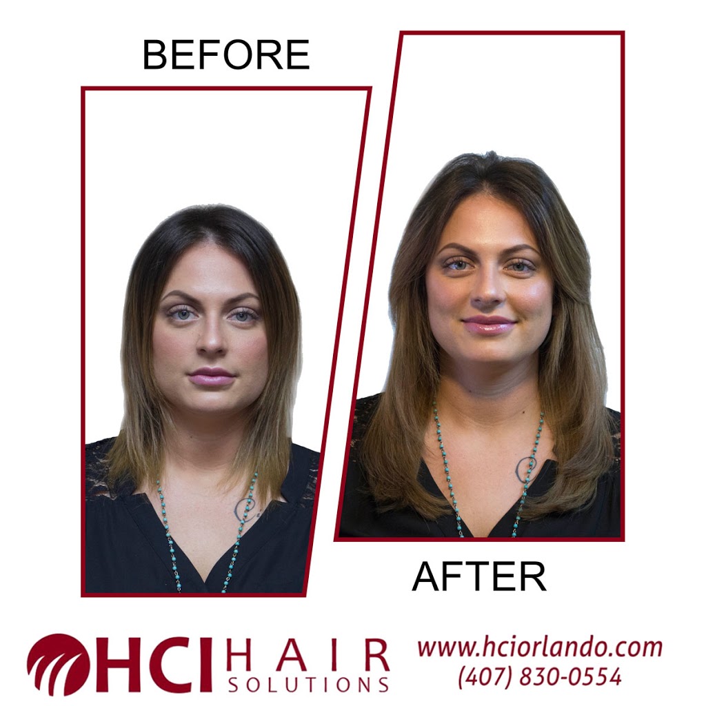 HCI Hair Solutions | 195 Briar Cliff Dr #102, Longwood, FL 32779, USA | Phone: (407) 830-0554
