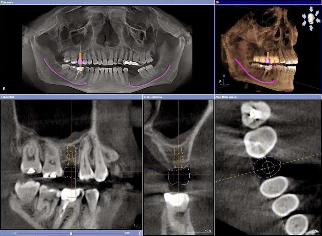 Holly Dental Associates | 8010 S Holly St, Littleton, CO 80122 | Phone: (303) 694-6400