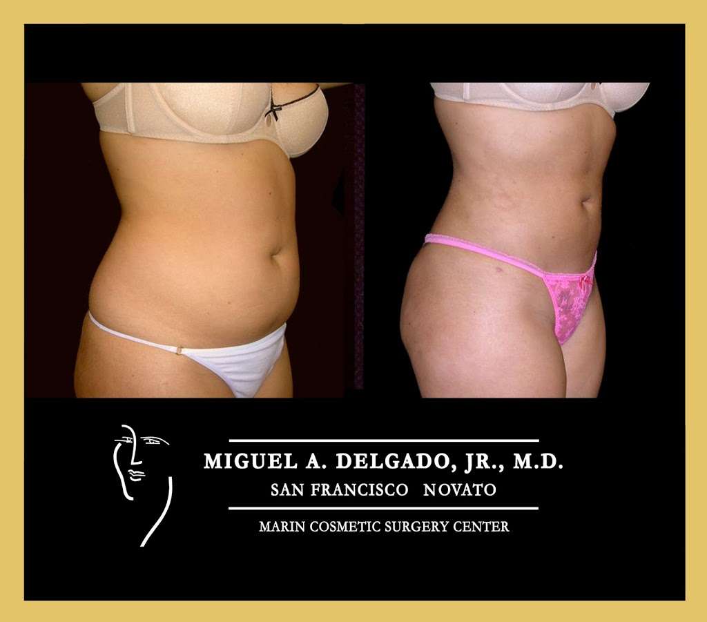 Miguel Delgado, M.D. | 165 Rowland Way Suite 300, Novato, CA 94945, USA | Phone: (415) 898-4161