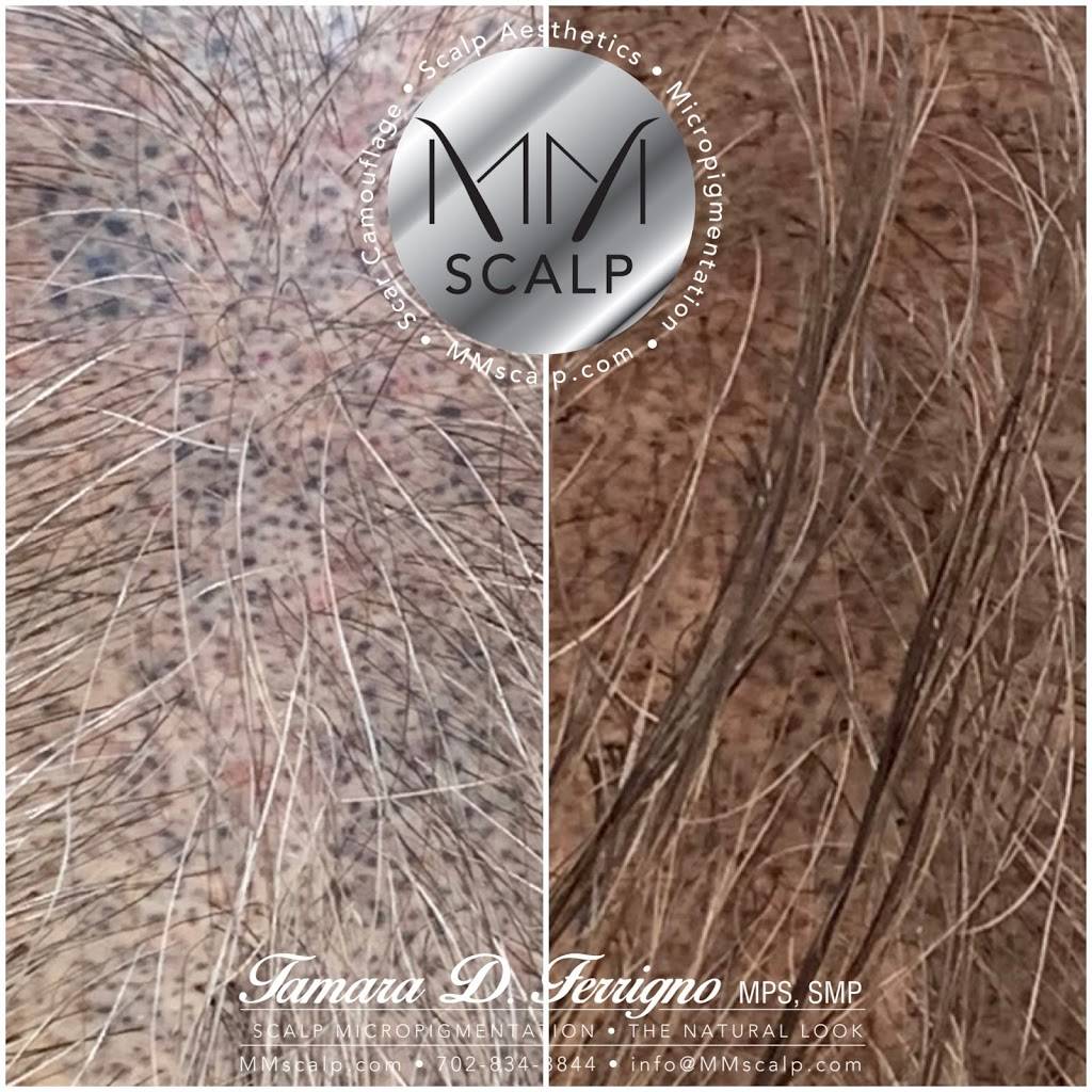 MM Scalp | 62 N Pecos Rd, Henderson, NV 89074, USA | Phone: (702) 834-3844