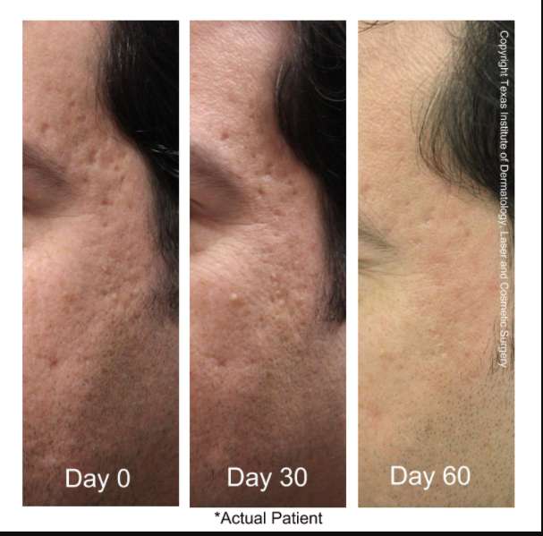 Texas Institute of Dermatology, Laser and Cosmetic Surgery | 24165 I-10, San Antonio, TX 78257, USA | Phone: (210) 698-6777