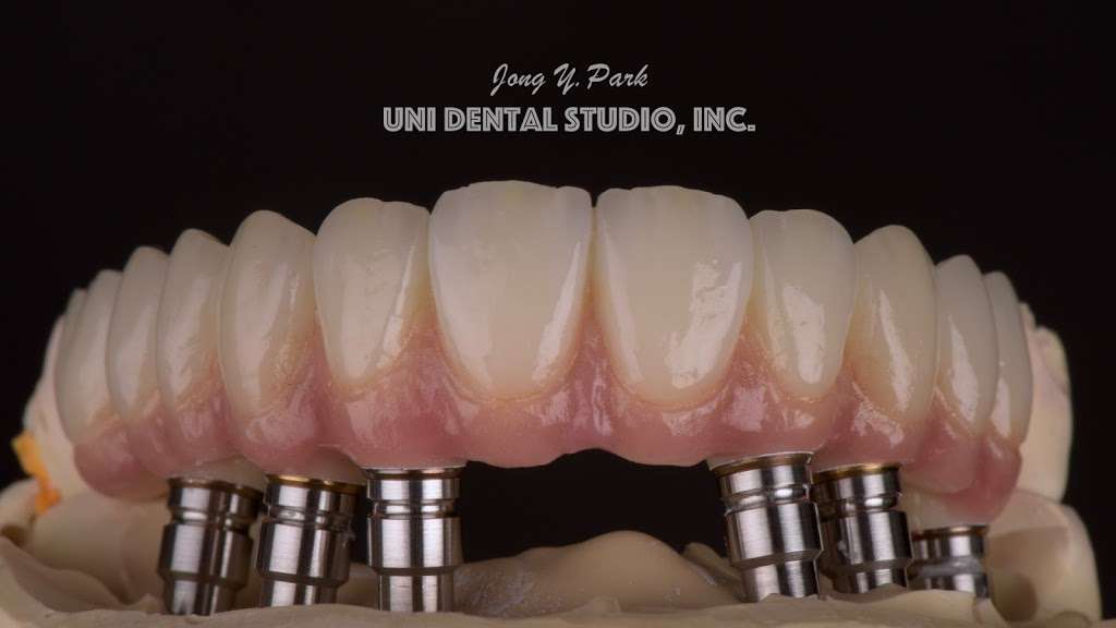 Uni Dental Studio, Inc. | 7120 Minstrel Way STE 105, Columbia, MD 21045, USA | Phone: (410) 381-2928