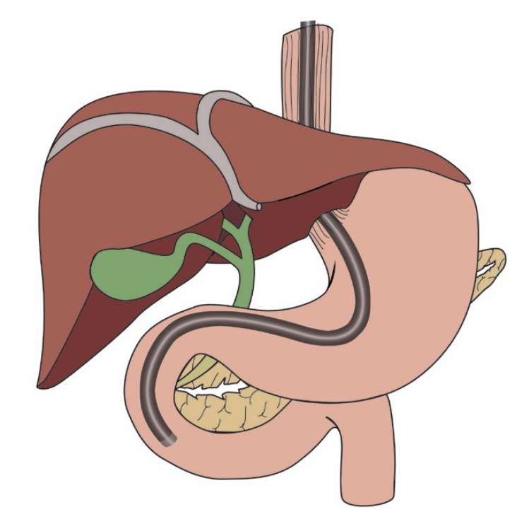 Gastroenterologist - Sumanth Daram, MD FACP | 15015 Kirby Dr, Houston, TX 77047, USA | Phone: (713) 343-6360