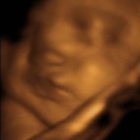 Prenatal Life Imagining 3D/4D Ultrasound | 2424 N Grand Ave Suite A, Santa Ana, CA 92705 | Phone: (714) 881-1213