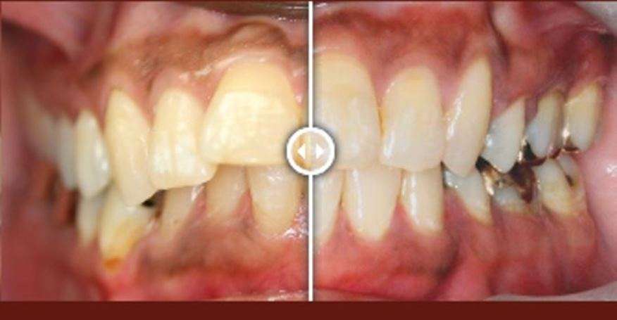 Alamo Ranch Orthodontics | 5616 Lone Star Pkwy #104, San Antonio, TX 78253, USA | Phone: (210) 920-4930 Alamo Ranch Orthodontics | 5616 Lone Star Pkwy #104, San Antonio, TX 78253, USA | Phone: (210) 920-4930