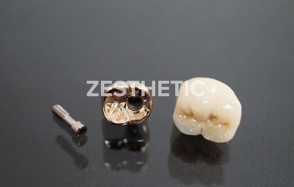 Zesthetic Dental Laboratory | 5150 E La Palma Ave #113, Anaheim, CA 92807, USA | Phone: (714) 340-3102