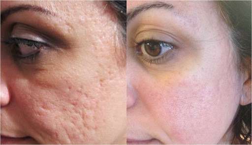 Amazing Skin | 13 Oakland Rd, Pepperell, MA 01463 | Phone: (978) 877-0972