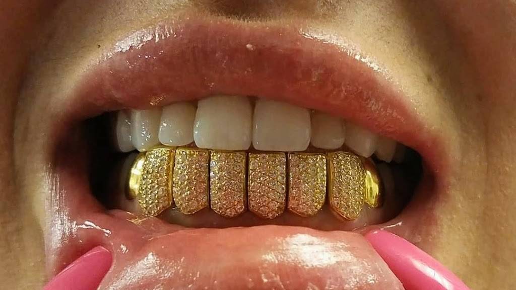 Gold Kutz Grillz By Moodurt | 2509 W Sylvania Ave #24, Toledo, OH 43613, USA | Phone: (419) 490-8741