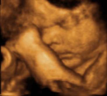 Amazing Baby 3D 4D Ultrasound | 7400 Louis Pasteur Dr Suite 106, San Antonio, TX 78229, USA | Phone: (210) 660-7337