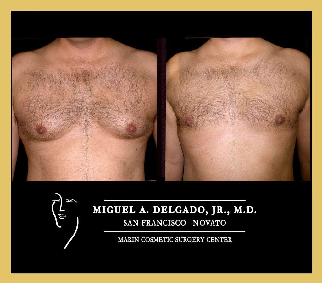 Miguel Delgado, M.D. | 165 Rowland Way Suite 300, Novato, CA 94945, USA | Phone: (415) 898-4161