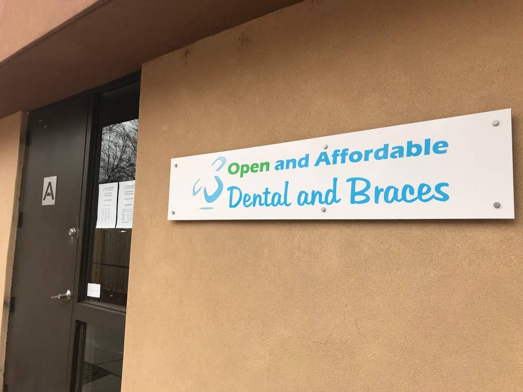 Open and Affordable Dental Denver East | 9450 E Mississippi Ave unit a, Denver, CO 80247, USA | Phone: (720) 463-2766