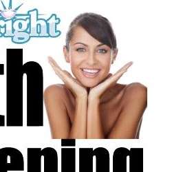 Instant Teeth Whitening | 24922 Tomball Pkwy, Tomball, TX 77375 | Phone: (281) 825-6054