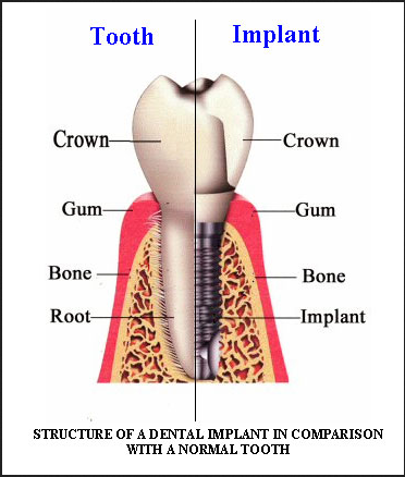 PURA DENTAL | 1507 Gessner Rd suite a, Houston, TX 77080, USA | Phone: (713) 858-8513