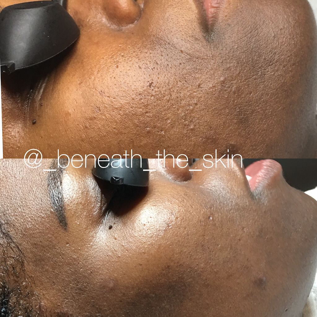 Beneath the Skin ~ Corrective Skincare Solutions | 8480 Baltimore National Pike #318, Ellicott City, MD 21043, USA | Phone: (301) 971-2769