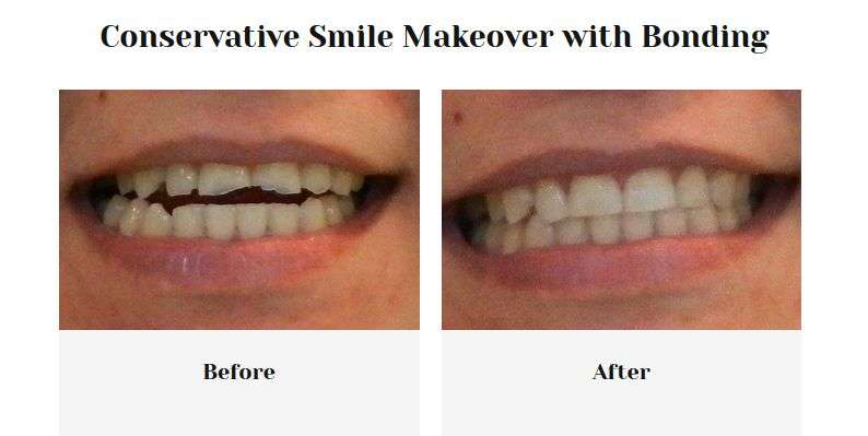 SmileSmart Dental: Cecelia Reid DDS | 4601 Avenue H Suite 1, Rosenberg, TX 77471, USA | Phone: (281) 239-3900