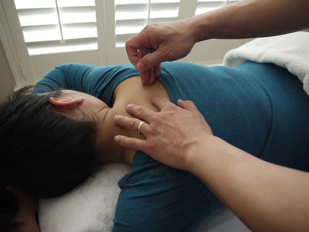 AQure Acupuncture Wellness Center | 6935 Cypress Creek Pkwy West, Suite B, ( inside Salon By JC ), Houston, TX 77069, USA | Phone: (281) 746-8099