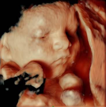 Miracle In Progress 3D/4D Ultrasound Studio | 2578 Belcastro St #103, Las Vegas, NV 89117 | Phone: (702) 255-4387