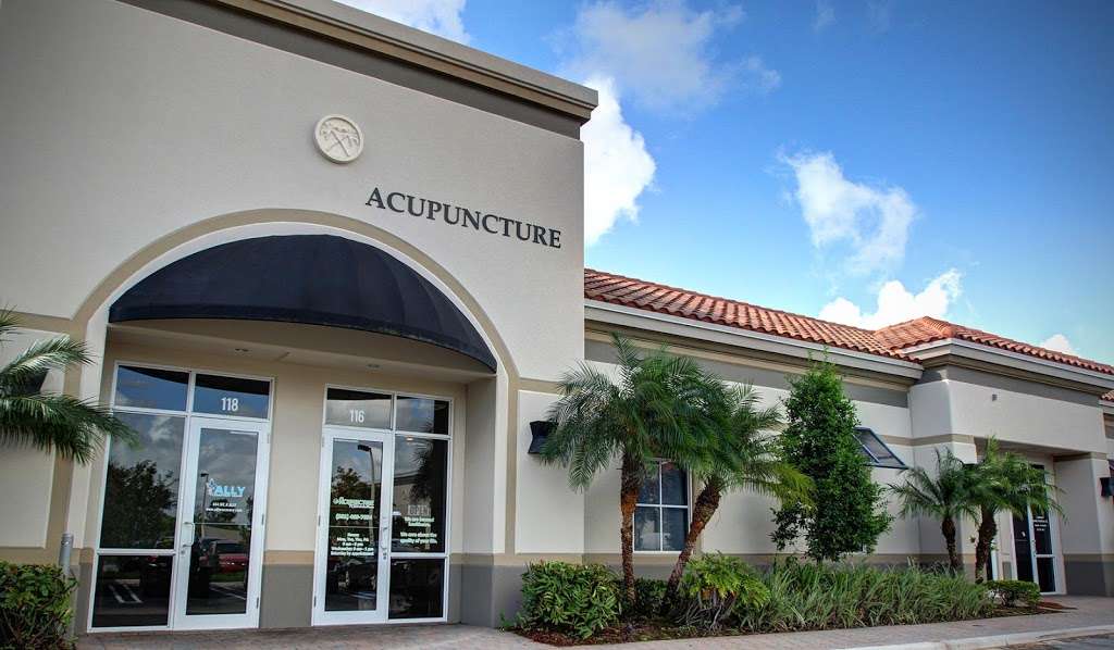 Team Acupuncture | 420 FL-7 Suite 116, Wellington, FL 33414, USA | Phone: (561) 469-7654