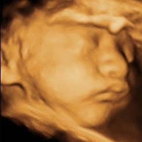 My First Peekaboo Ultrasound | 2300 Alessandro Dr #110, Ventura, CA 93001, USA | Phone: (805) 845-6500