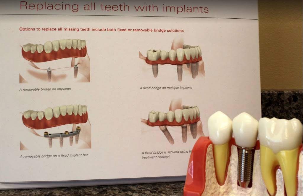 Dentistry At Its Finest: Dentist - Implant | 1202 Bristol St #120, Costa Mesa, CA 92626, USA | Phone: (949) 239-0020