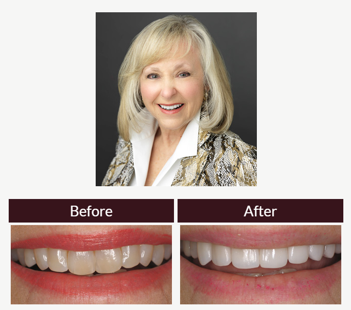 Scott Young, DDS | 6769 Lake Woodlands Dr Suite G, The Woodlands, TX 77382, USA | Phone: (832) 610-3123