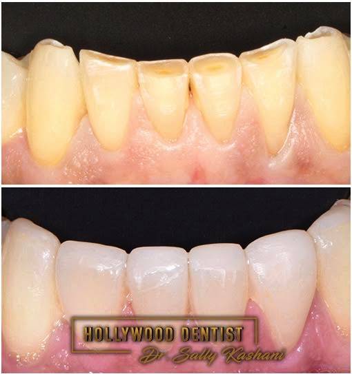 Dr. Sally Kashani DDS - Hollywood Dentist | 10719 Riverside Dr, Toluca Lake, CA 91602, USA | Phone: (818) 508-7272